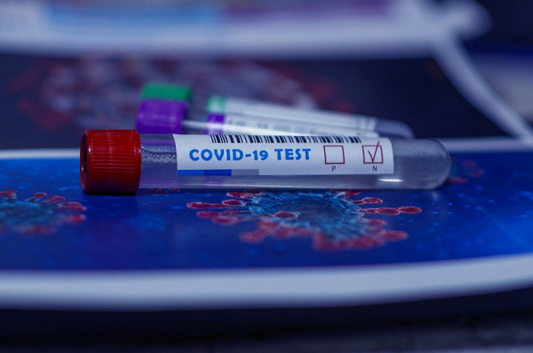 Lidé se můžou nechat zdarma testovat preventivními antigenními testy